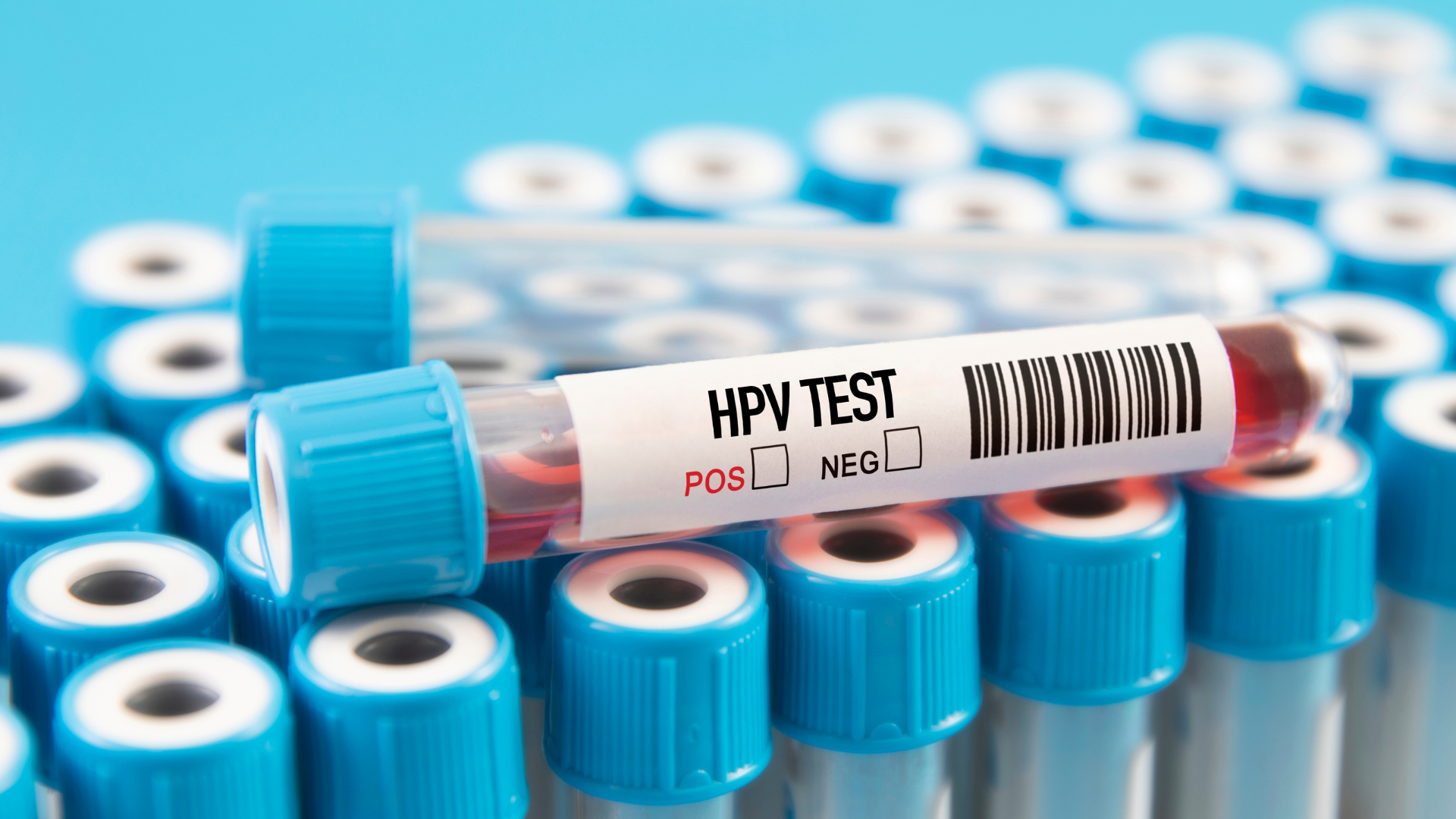 hasil-tes-hpv-positif-apakah-berarti-kanker